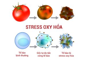 stress-oxy-hoa-1